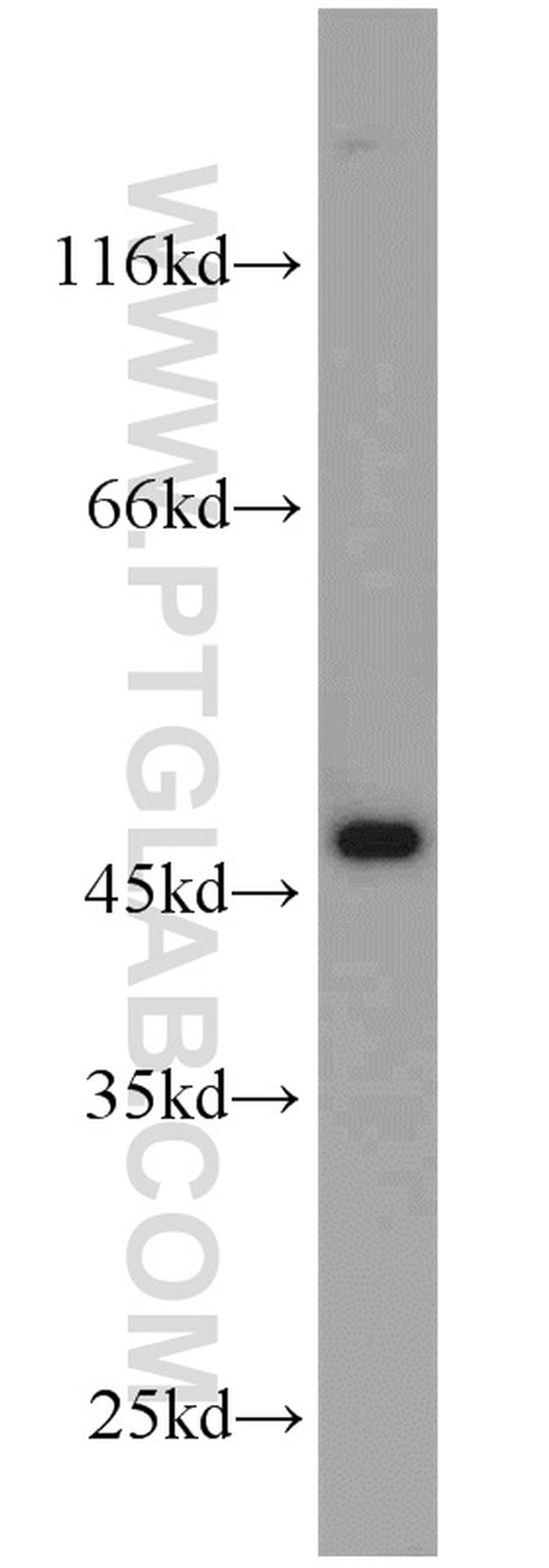 ADH7 Antibody in Western Blot (WB)