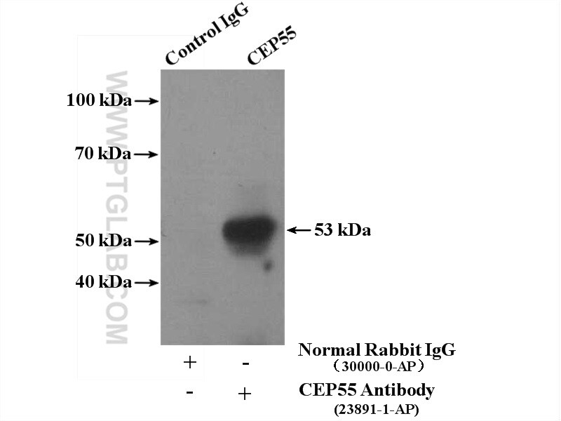 CEP55 Antibody in Immunoprecipitation (IP)