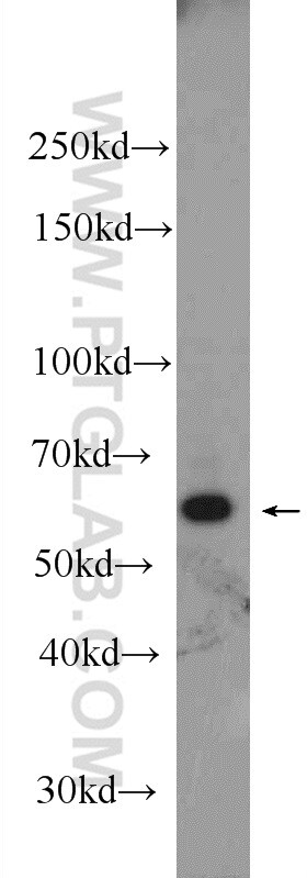 SHP1 Antibody in Western Blot (WB)