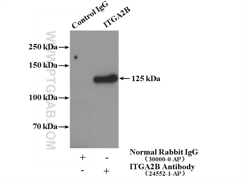 CD41/Integrin alpha 2b Antibody in Immunoprecipitation (IP)