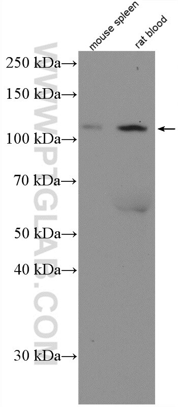 CD41/Integrin alpha 2b Antibody in Western Blot (WB)