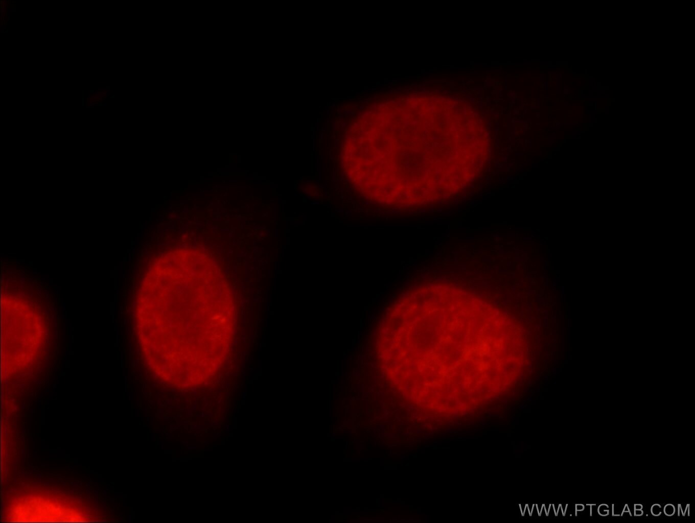 FUBP1 Antibody in Immunocytochemistry (ICC/IF)