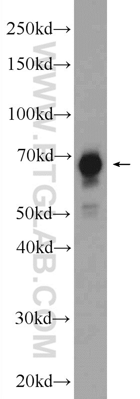 FUBP1 Antibody in Western Blot (WB)