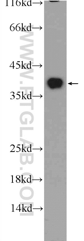 EXOSC7 Antibody in Western Blot (WB)