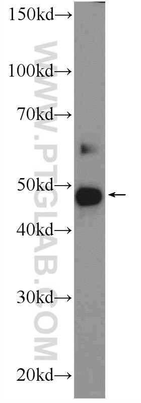 ZDHHC7 Antibody in Western Blot (WB)