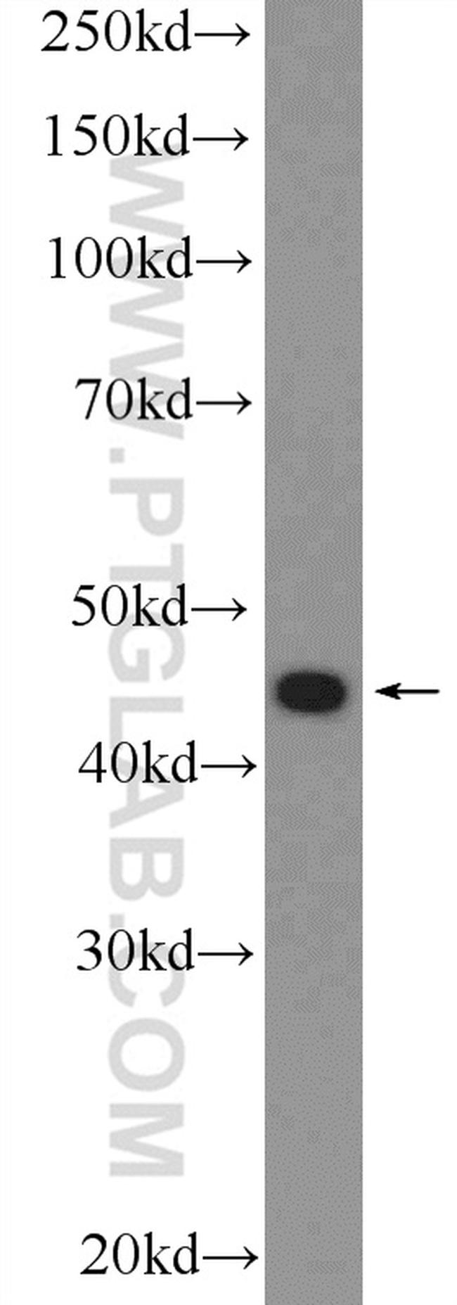 ZDHHC7 Antibody in Western Blot (WB)
