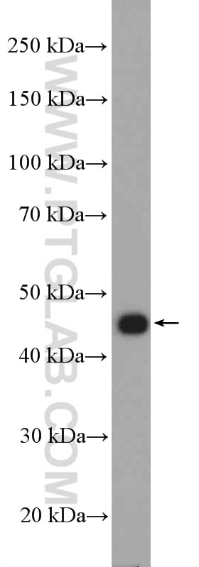 AKD2 Antibody in Western Blot (WB)