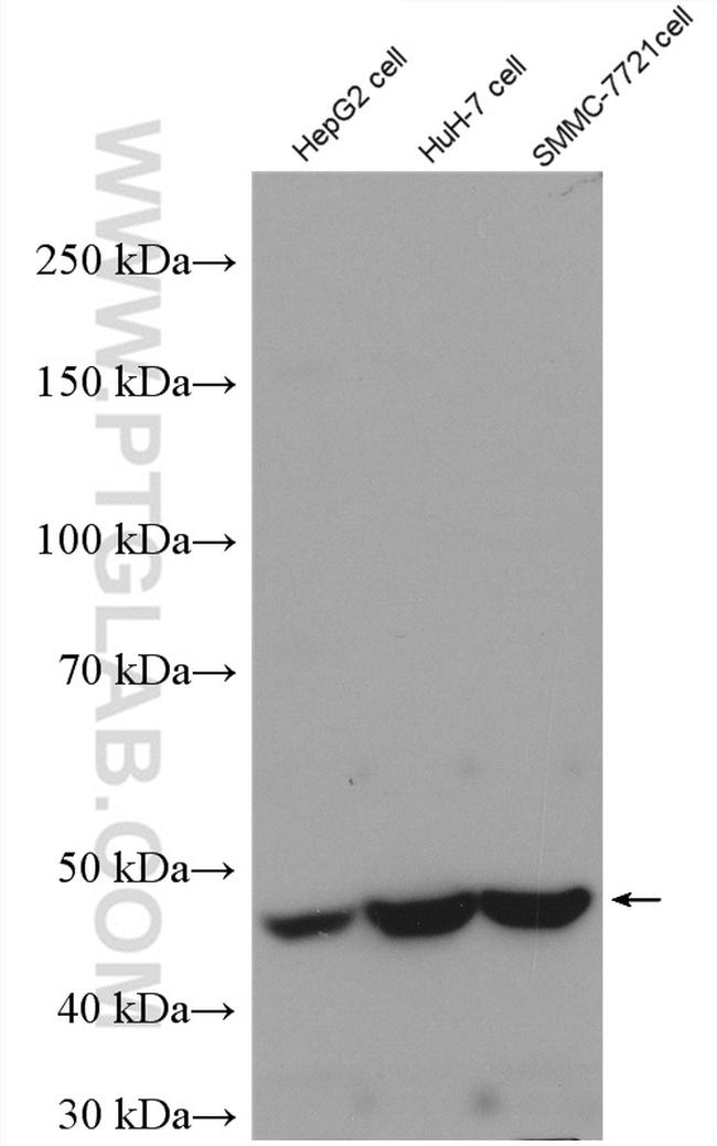 AKD2 Antibody in Western Blot (WB)