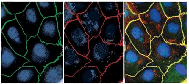 Zo 1 Antibody 40 20