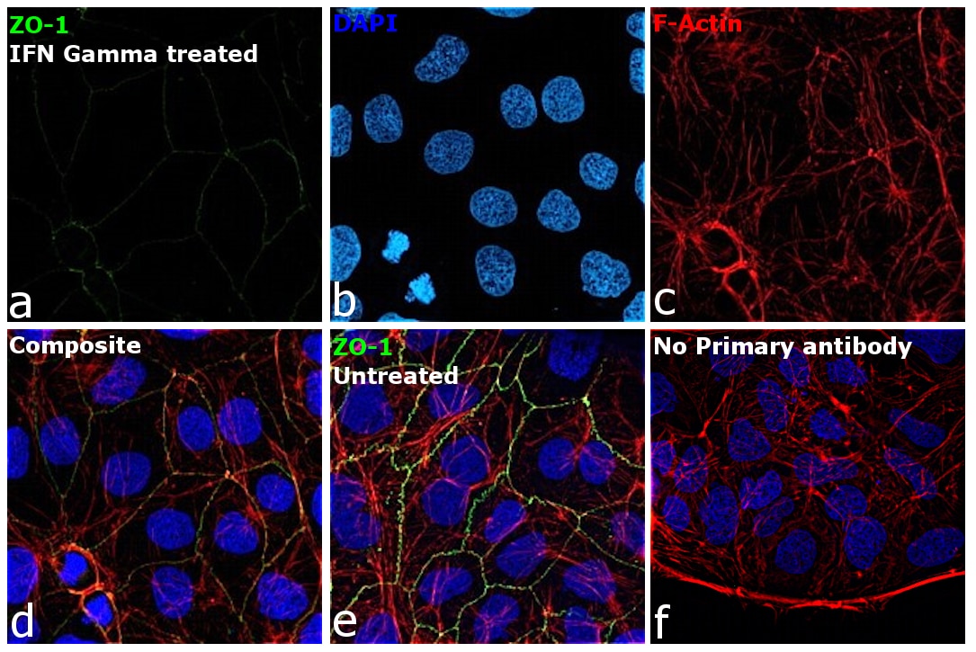 Zo 1 Antibody 40 20