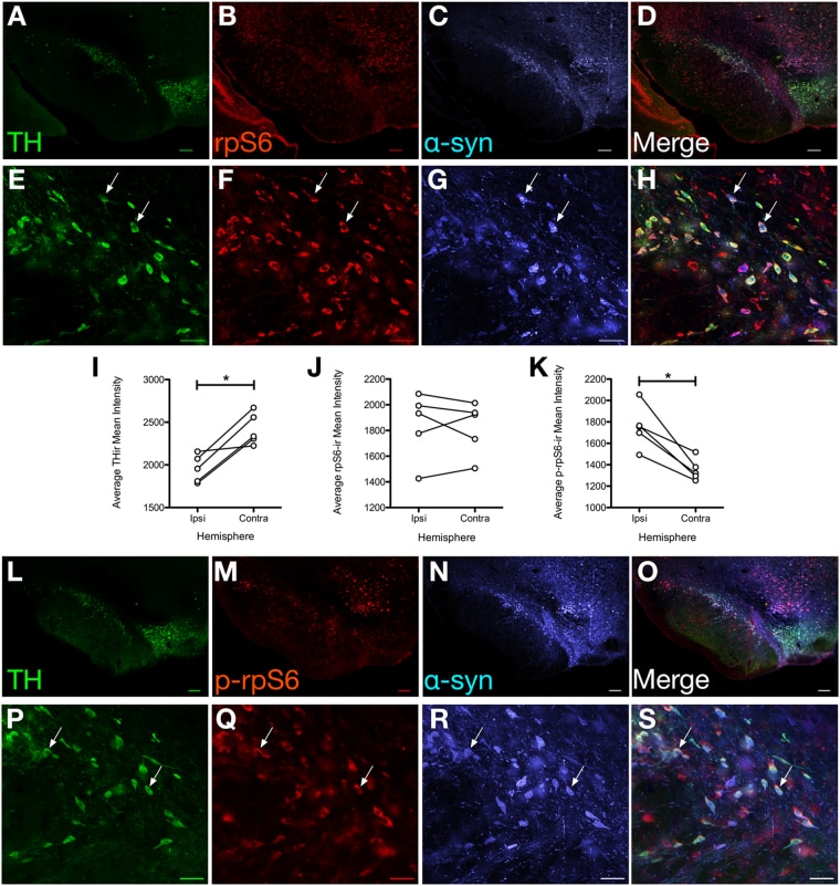 alpha Synuclein Antibody in Immunohistochemistry (IHC)