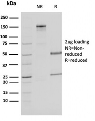 Malate dehydrogenase 1 NAD (soluble) Antibody