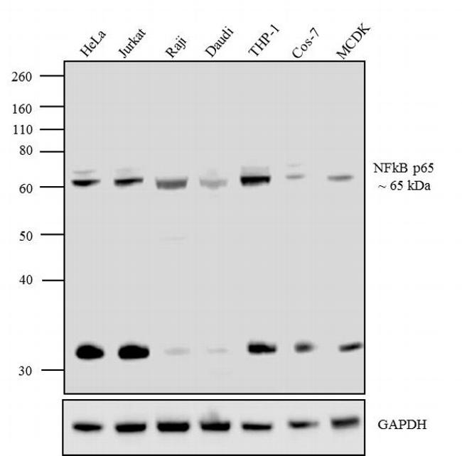 NFkB p65 Antibody in Western Blot (WB)