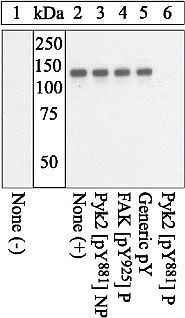 Phospho-PYK2 (Tyr881) Antibody