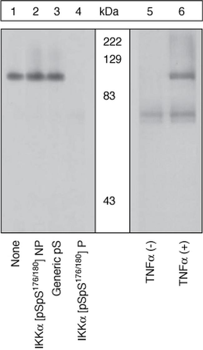 Phospho-IKK alpha (Ser176, Ser180) Antibody