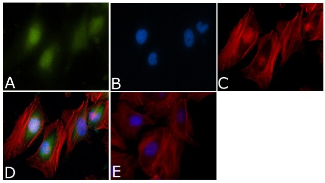 458900-Aurora-A-Kinase-IF.jpg