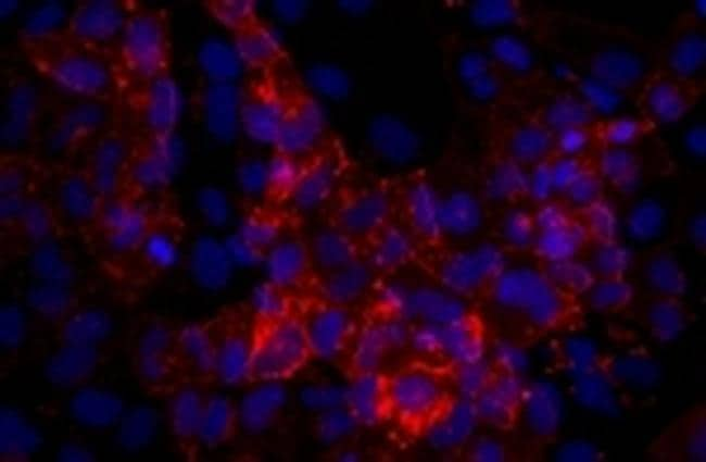 SSEA4 Antibody, eFluor™ 660 (50-8843-82)