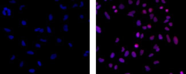 EZH2 Antibody, eFluor® 660 (50-9867-82)