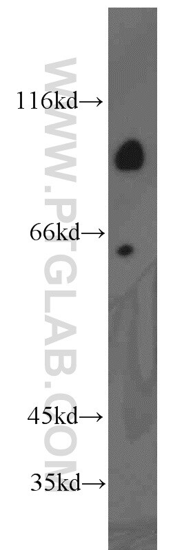 ARHGAP10 Antibody in Western Blot (WB)
