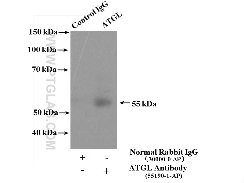 ATGL Antibody in Immunoprecipitation (IP)