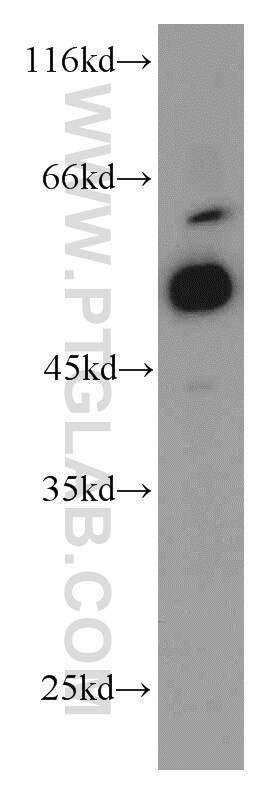 ATGL Antibody in Western Blot (WB)