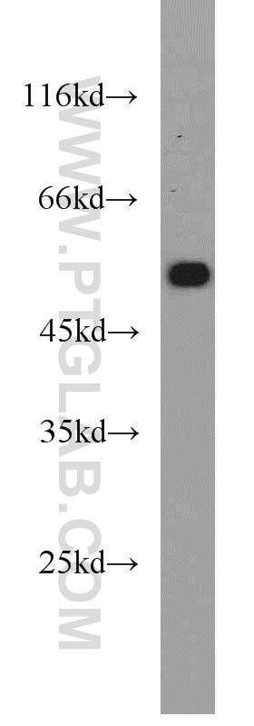 ATGL Antibody in Western Blot (WB)