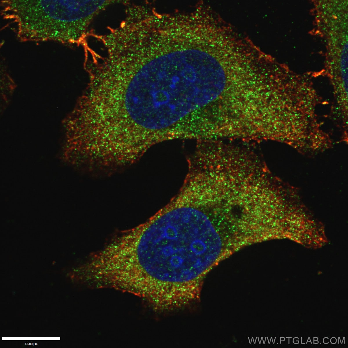 LAMP1 Antibody (55273-1-AP)