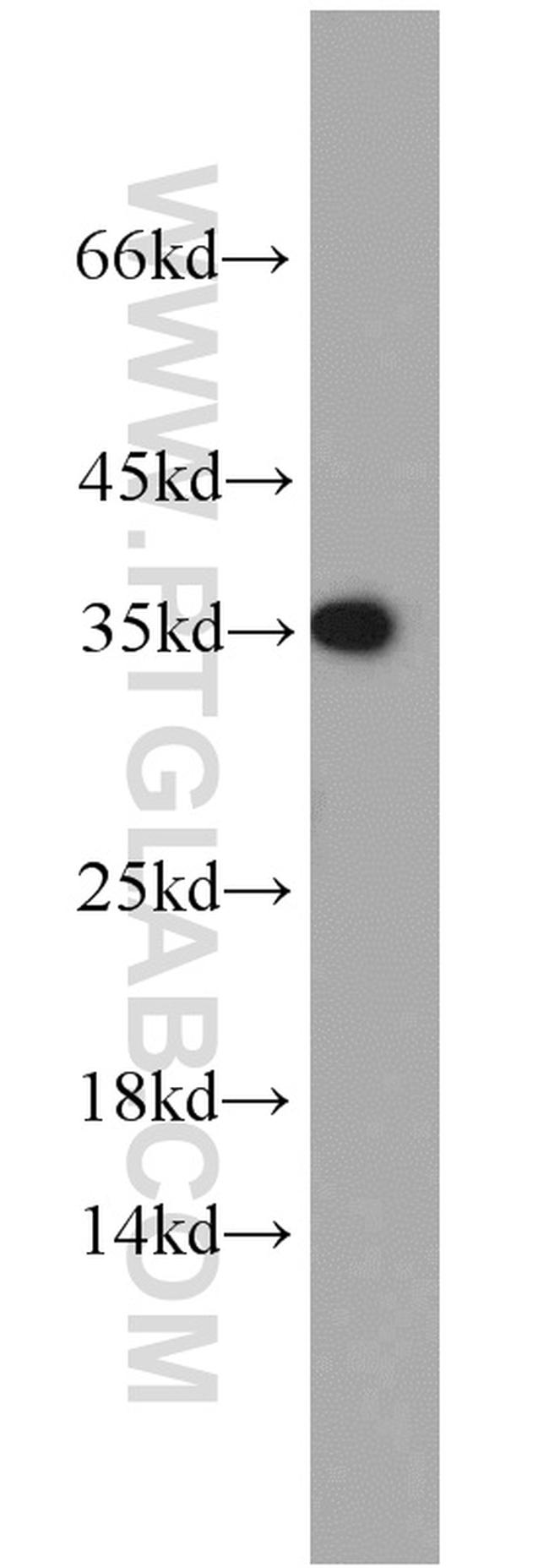 PKA C-beta Antibody in Western Blot (WB)