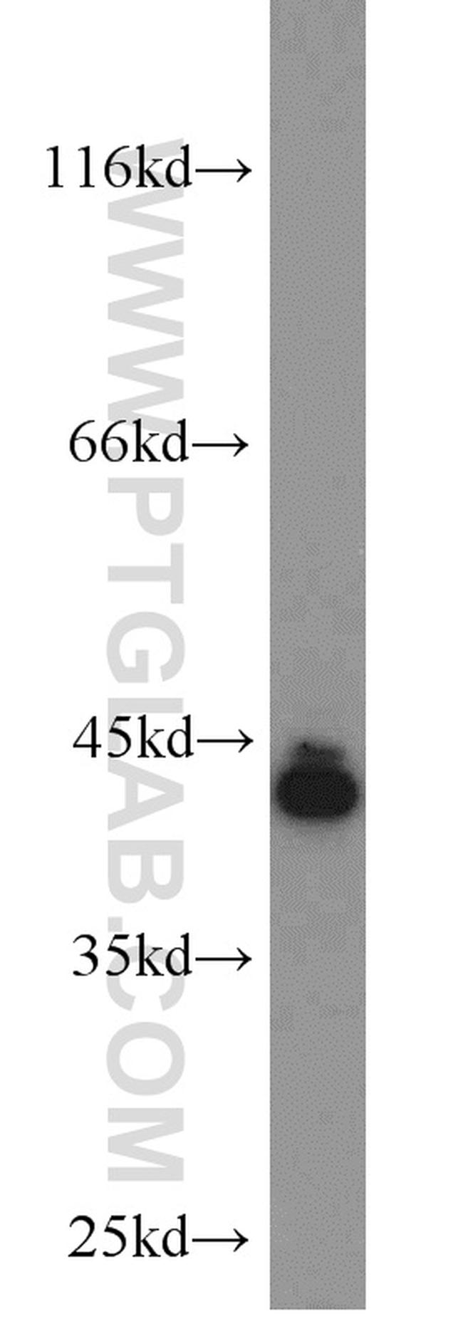 SCARA5 Antibody in Western Blot (WB)