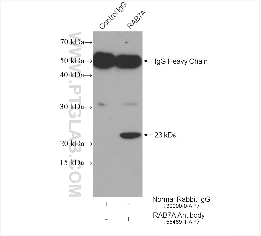 RAB7A Antibody in Immunoprecipitation (IP)