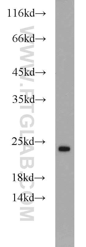RAB7A Antibody in Western Blot (WB)