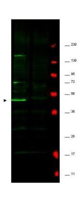 Fbp5A Antibody in Western Blot (WB)
