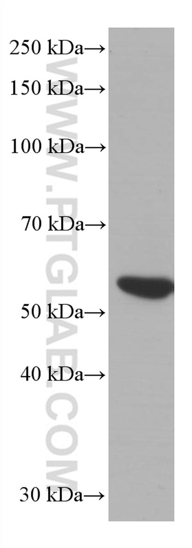 LCK Antibody (60162-1-IG)