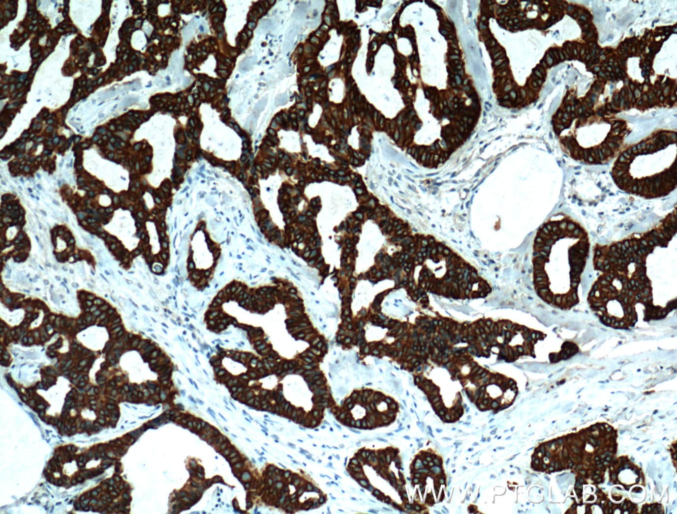 TNF alpha Antibody (60291-1-IG)