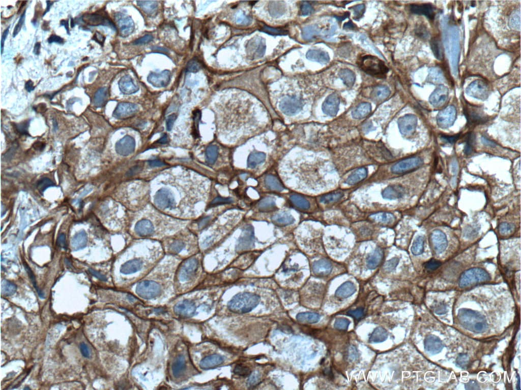 pan Ras Antibody (60309-1-IG)