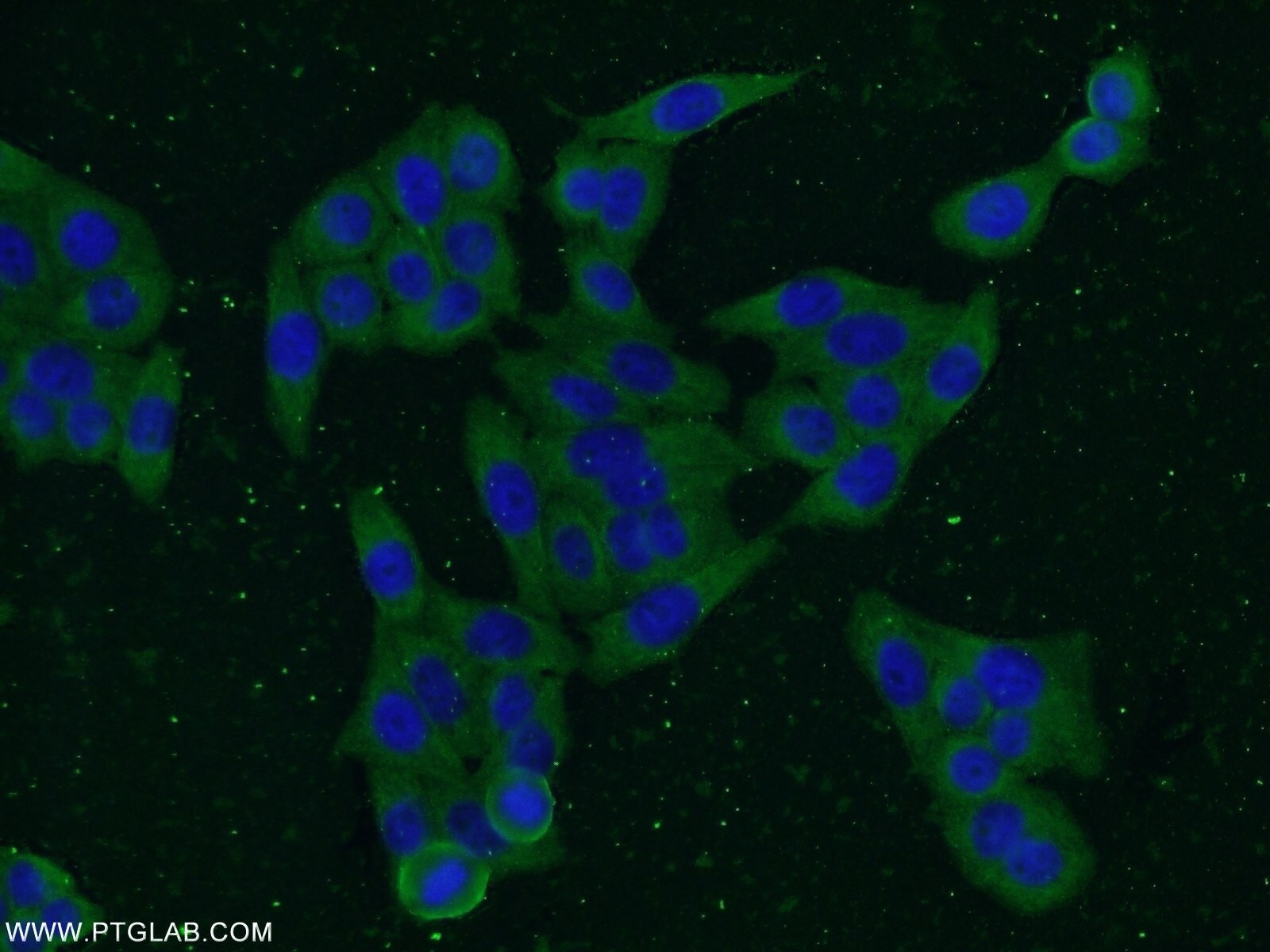 Vimentin Antibody (60330-1-IG)