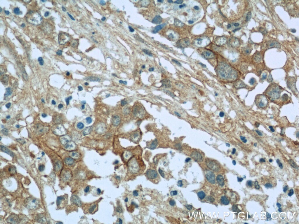 Cadherin-17 Antibody (60351-1-IG)