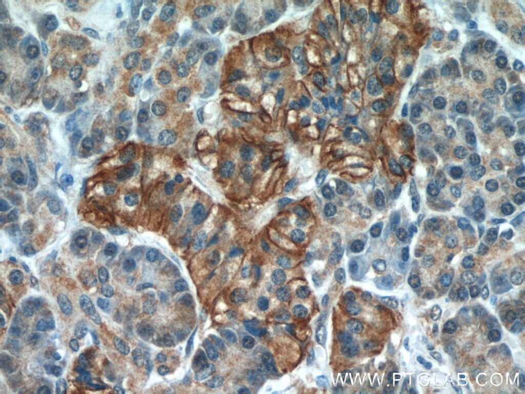 Cadherin-17 Antibody (60351-1-ig)