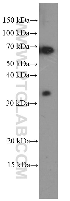TIM3 Antibody in Western Blot (WB)