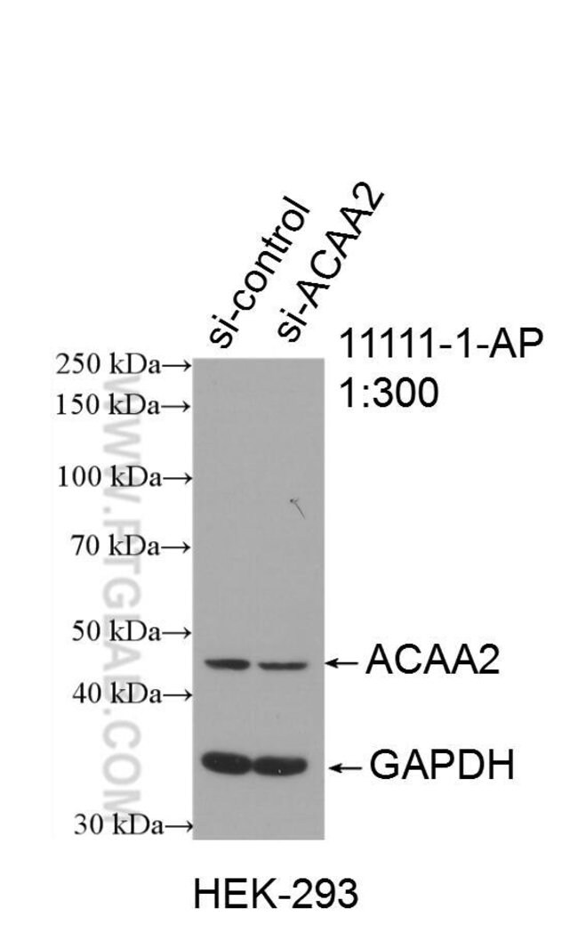 Acaa2 Antibody 1 Ap