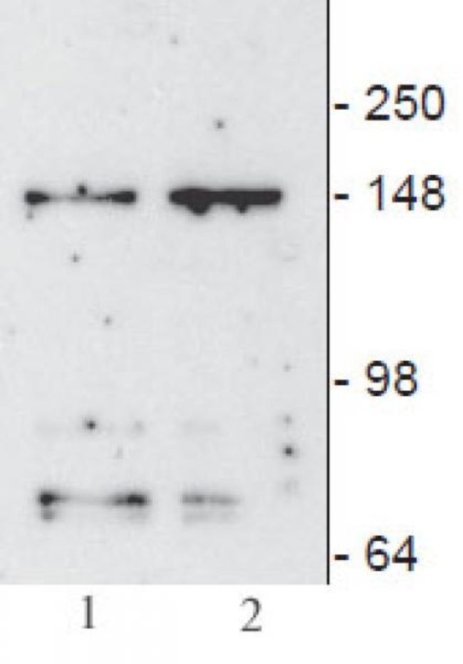 Jmjd3 Kdm6b Antibody 61387