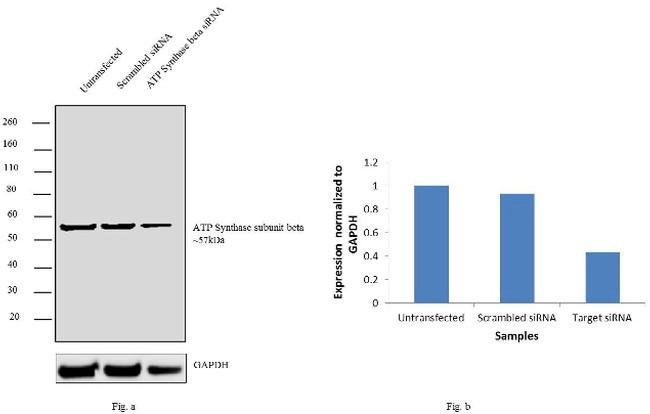 Atp Synthase Beta Antibody A