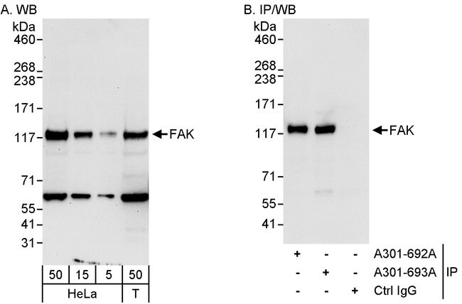 FAK Antibody (A301-693A)