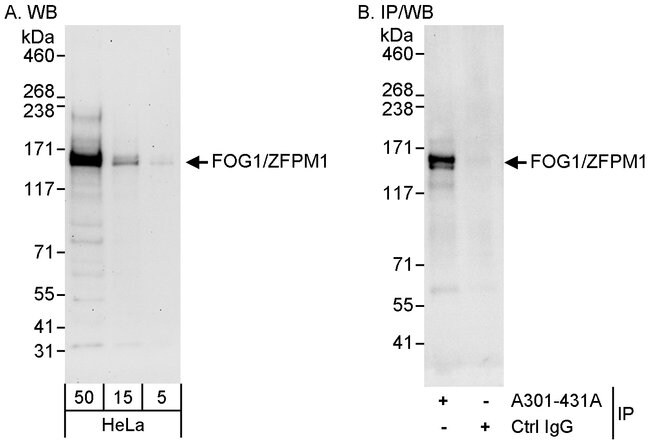 Fog1 Zfpm1 Antibody A301 431a