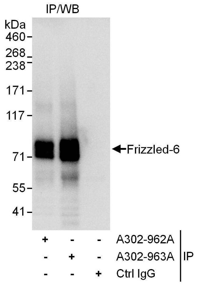 Frizzled 6 Antibody A302 963a