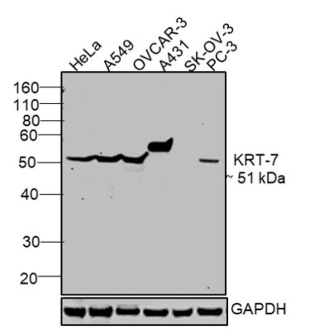 Cytokeratin 7 Antibody Ma5 15604