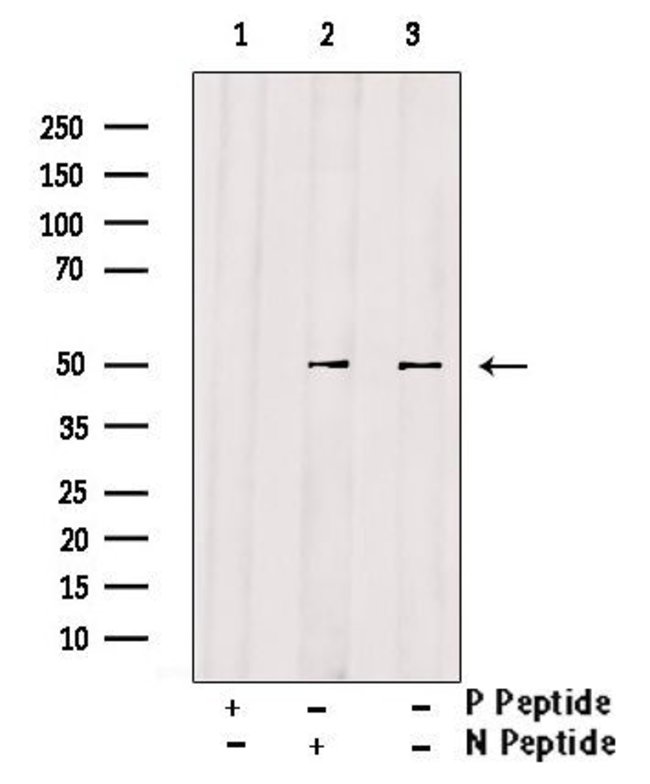 Phospho Eed Thr55 Antibody Pa5 105333