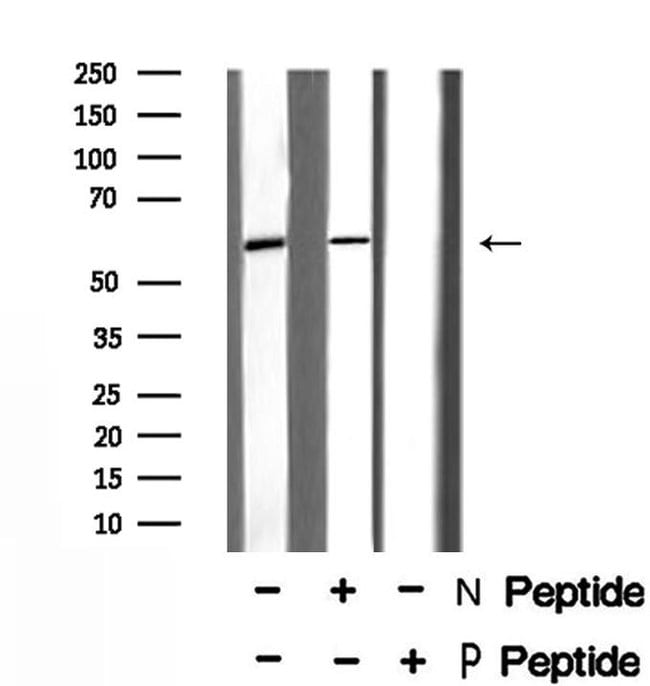 Phospho Irf5 Ser437 Antibody Pa5 106093