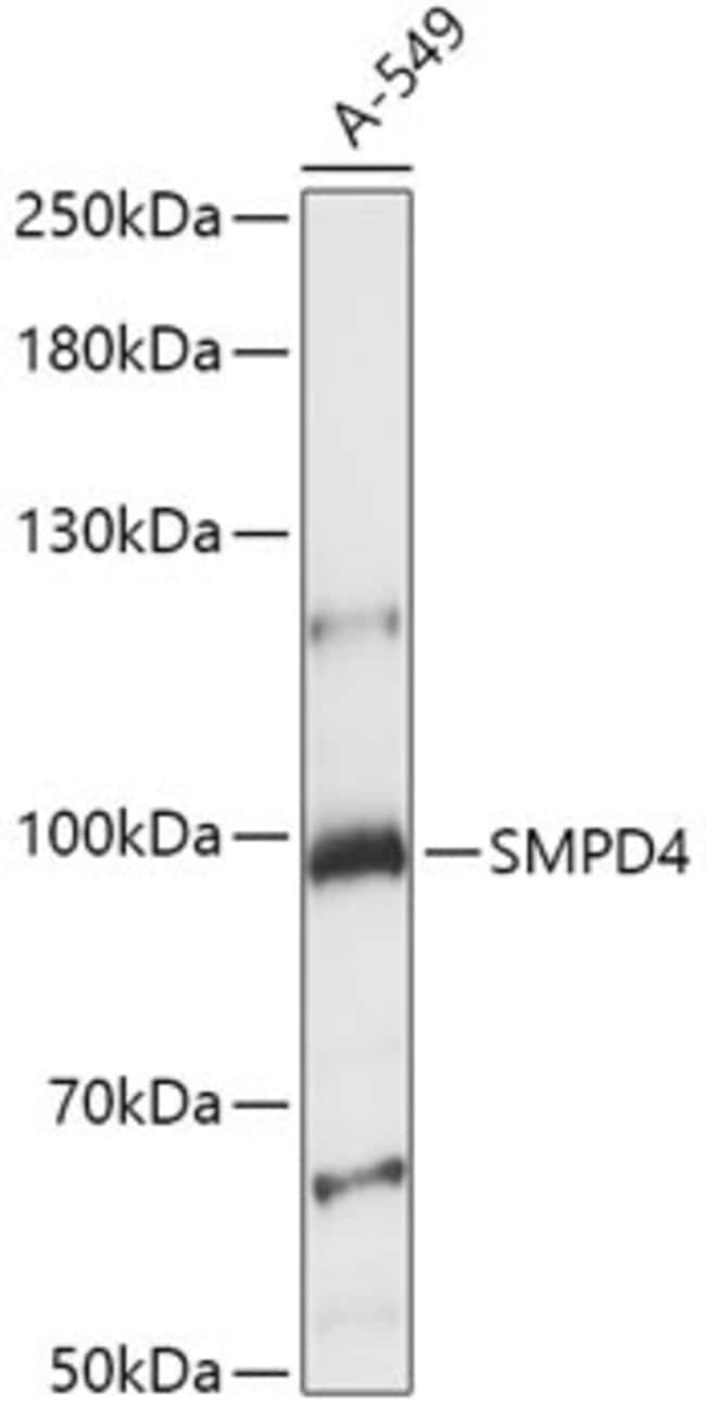 Smpd4 Antibody Pa5