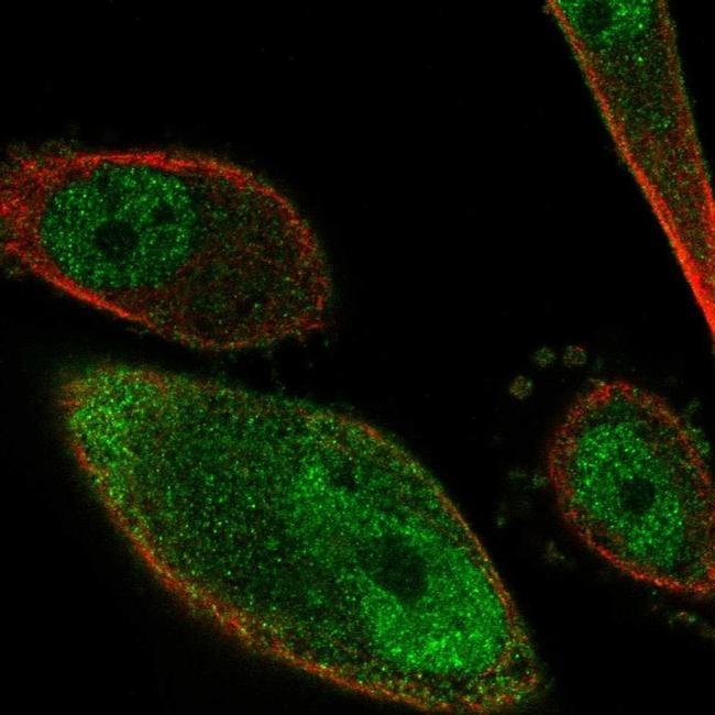 Pkig Antibody Pa5